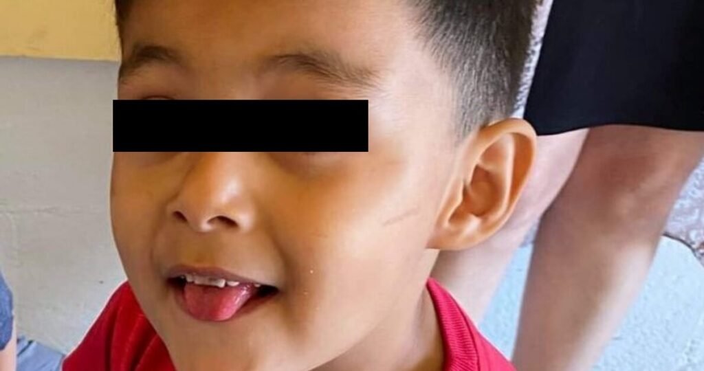 Niño va al dentista por dolor de muela y muere en el consultorio.