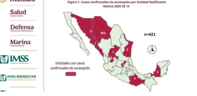 🦠 México confirma 421 casos de sarampión en 2025; el grupo más afectado es de 25 a 44 años
